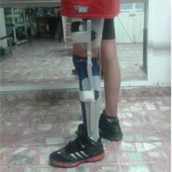 Programa Modular en Ortésica del Miembro Inferior