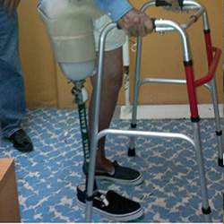 Diplomado en Rehabilitación Protésica del Miembro Inferior